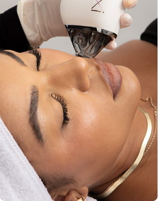 Microneedling Featured Image