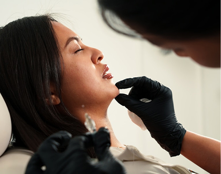 Dermal Fillers Image